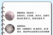 揭秘狗常见的皮肤病，保护你的宠物健康（狗皮肤病种类及预防措施，让你的狗狗舒服无忧）