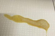 以比熊犬拉稀的治疗方法和药物选择（了解狗狗拉稀的原因和合适的药物治疗方法）