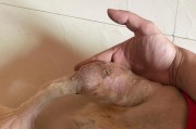 金毛犬为什么总啃尾巴？（探究金毛犬啃尾巴的原因及解决方法）