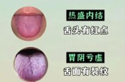 舌头颜色的指示——看懂你的身体健康（舌苔的颜色和健康关联密切）