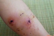 狗狗受伤急需急救，这些方法你要知道（保护你的狗狗免受同类咬伤或伤害）