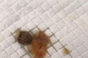 小狗身上的蛔虫引发的健康问题（以小狗拉出来的蛔虫为例，分析宠物身上蛔虫带来的影响及预防方法）