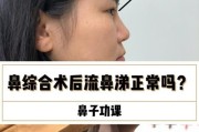 老流脓鼻涕的原因及治疗方法（老年人流脓鼻涕的常见病因和自我护理方法）