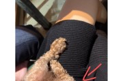 泰迪髌骨内脱症的原因及处理方法（为什么泰迪会出现髌骨内脱症？如何有效预防和治疗？）